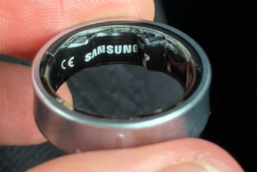 Swollen Galaxy Ring battery gets stuck on finger, leads to hospital visit [Gallery]